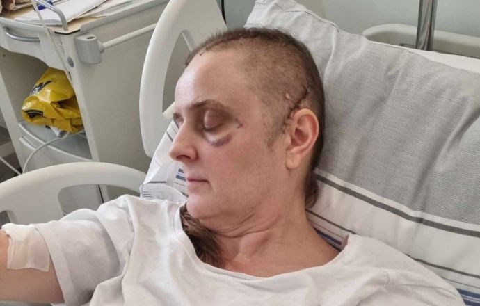 Zbiórka na leczenie i rehabilitację Marzeny 